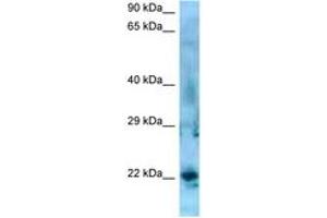 Image no. 1 for anti-Synovial Sarcoma, X Breakpoint 5 (SSX5) (AA 119-168) antibody (ABIN6748426) (SSX5 抗体  (AA 119-168))
