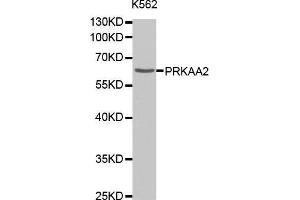 Western Blotting (WB) image for anti-Protein Kinase, AMP-Activated, alpha 2 Catalytic Subunit (PRKAA2) antibody (ABIN1678656) (PRKAA2 抗体)