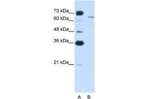 WB Suggested Anti-CPEB2 Antibody Titration:  0. (CPEB2 抗体  (N-Term))