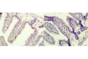 Immunohistochemistry (Paraffin-embedded Sections) (IHC (p)) image for anti-Eukaryotic Translation Initiation Factor 4E Binding Protein 1 (EIF4EBP1) (pThr37), (pThr46) antibody (ABIN682978)