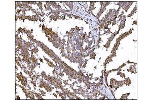 IHC analysis of LRP1B using anti-LRP1B antibody (ABIN7601521). (LRP1B 抗体  (AA 3704-4547))