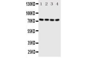 Western Blotting (WB) image for anti-P21-Activated Kinase 6 (PAK6) (AA 16-32), (N-Term) antibody (ABIN3044285)