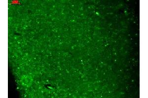 Image no. 2 for anti-Calcium Channel, Voltage-Dependent, T Type, alpha 1H Subunit (CACNA1H) (AA 1019-1293) antibody (ABIN361762)