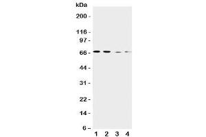 Western blot testing of CAT1 antibody and Lane 1:  human placenta (SLC7A1 抗体  (C-Term))