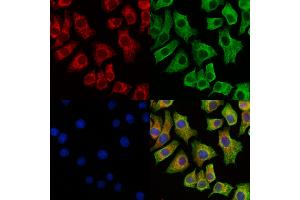 ABIN7094347 and ABIN7098394 staining HepG2 cells by IF/ICC.