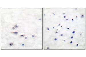 Immunohistochemical analysis of paraffin-embedded human brain tissue using Shc (phospho-Tyr427) antibody. (SHC1 抗体  (pTyr427))