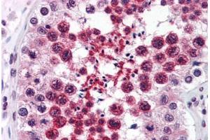 Human Testis (formalin-fixed, paraffin-embedded) stained with RTN4 antibody ABIN343915 at 3 ug/ml followed by biotinylated goat anti-rabbit IgG secondary antibody ABIN481713, alkaline phosphatase-streptavidin and chromogen. (Reticulon 4 抗体  (Internal Region))