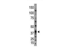 Image no. 1 for anti-Growth Differentiation Factor 1 (GDF1) (N-Term) antibody (ABIN357457) (GDF1 抗体  (N-Term))
