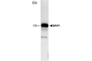 BRIP1 detected in 293 cell lysate using BRIP1 monoclonal antibody, clone pp15-IB4 .
