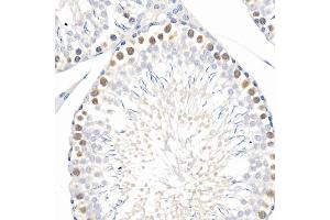 Immunohistochemistry of paraffin-embedded mouse lung using Phospho--S473 Rabbit mAb (ABIN6135179, ABIN6135970, ABIN6135971 and ABIN7101880) at dilution of 1:100 (40x lens). (AKT1 抗体  (pSer473))