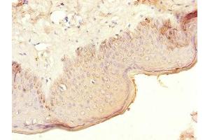 Immunohistochemistry (IHC) image for anti-Corticotropin Releasing Hormone Receptor 1 (CRHR1) (AA 24-121) antibody (ABIN7148625)