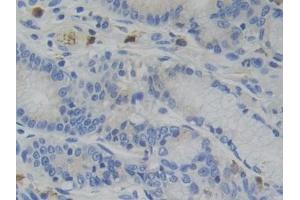 Immunohistochemistry (IHC) image for anti-Nuclear Receptor Subfamily 3, Group C, Member 1 (Glucocorticoid Receptor) (NR3C1) (AA 598-755) antibody (ABIN7445486)