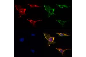 ABIN6265959 and ABIN6268944 staining HepG2 by IF/ICC.