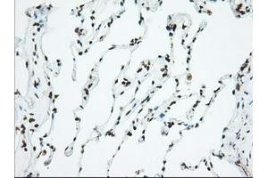 Image no. 3 for anti-Ubiquitin Specific Peptidase 5 (USP5) antibody (ABIN1501693) (USP5 抗体)