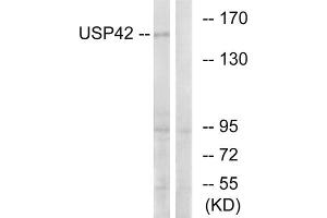 Western blot analysis of extracts from HT-29 cells, using USP42 antibody. (USP42 抗体  (Internal Region))