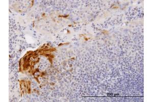 Immunoperoxidase of purified MaxPab antibody to S100A7 on formalin-fixed paraffin-embedded human tonsil. (S100A7 抗体  (AA 1-101))