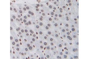IHC-P analysis of liver tissue, with DAB staining. (NXF1 抗体  (AA 2-197))