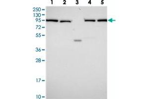 Western blot analysis of Lane 1: RT-4, Lane 2: U-251 MG, Lane 3: Human Plasma, Lane 4: Liver, Lane 5: Tonsil with INO80D polyclonal antibody . (IN80D 抗体)