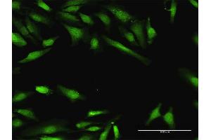 Immunofluorescence of purified MaxPab antibody to BIN1 on HeLa cell. (BIN1 抗体  (AA 1-482))