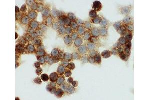 ICC testing of HNF6 antibody and HCT116 cells (ONECUT1 抗体  (N-Term))