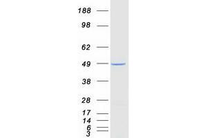 Western Blotting (WB) image for Poly(rC) Binding Protein 4 (PCBP4) (Transcript Variant 3) protein (Myc-DYKDDDDK Tag) (ABIN2728358)