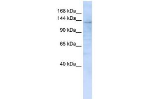 IMPG2 antibody used at 1 ug/ml to detect target protein. (IMPG2 抗体  (C-Term))