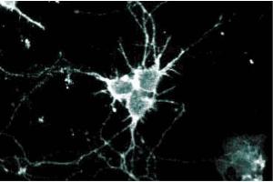 Immunofluorescence staining of rat neurons at 5 µg/ml of the anti-Ral A antibody. (rala 抗体  (AA 35-206))