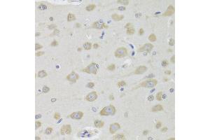 Immunohistochemistry of paraffin-embedded rat brain using DHRS9 Antibody (ABIN5973740) at dilution of 1/100 (40x lens). (DHRS9 抗体)