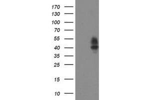 Western Blotting (WB) image for anti-Leucine Rich Repeat Containing 25 (LRRC25) antibody (ABIN1499201)