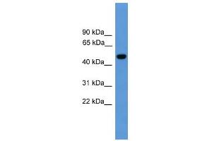 WB Suggested Anti-PSEN1 Antibody Titration: 0. (Presenilin 1 抗体  (Middle Region))