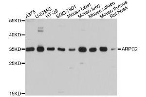 Western blot analysis of extracts of various cell lines, using ARPC2 antibody. (ARPC2 抗体  (AA 1-300))