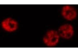 ABIN6268809 staining K-562 cells by IF/ICC. (HNRNPC 抗体  (C-Term))