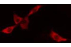 ABIN6268850 staining A549 cells by IF/ICC. (DCT 抗体  (N-Term))