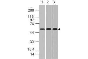 Image no. 1 for anti-RanBP-Type and C3HC4-Type Zinc Finger Containing 1 (RBCK1) (AA 121-333) antibody (ABIN5027252) (RBCK1 抗体  (AA 121-333))