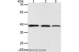 Western blot analysis of PC3 cell, human seminoma and mouse testis tissue, using AMD1 Polyclonal Antibody at dilution of 1:400 (AMD1 抗体)