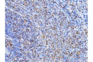 Immunohistochemistry (Paraffin-embedded Sections) (IHC (p)) image for anti-Actin, beta (ACTB) antibody (ABIN3020544)