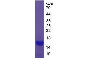 SDS-PAGE of Protein Standard from the Kit  (Highly purified E. (CEA ELISA 试剂盒)