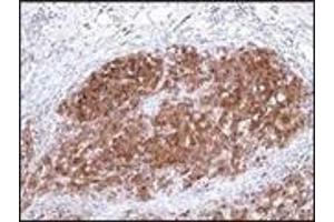 Immunohistochemistry (IHC) image for anti-S-100 (C-Term) antibody (ABIN870446) (S-100 抗体  (C-Term))