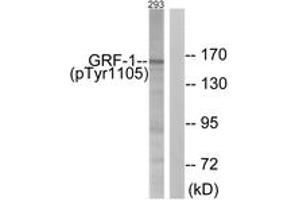 Western Blotting (WB) image for anti-Glucocorticoid Receptor DNA Binding Factor 1 (GRLF1) (AA 1071-1120), (pTyr1105) antibody (ABIN1531278)
