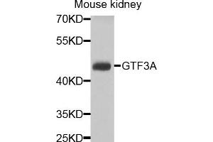 Western blot analysis of extracts of mouse kidney cells, using GTF3A antibody. (GTF3A 抗体)