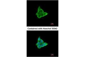 ICC/IF Image Immunofluorescence analysis of paraformaldehyde-fixed A431, using CIS, antibody at 1:200 dilution. (CISH 抗体  (C-Term))