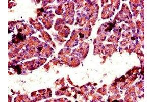 Immunohistochemistry of paraffin-embedded human pancreatic tissue using ABIN7147742 at dilution of 1:100 (Chymotrypsin 抗体  (AA 90-220))