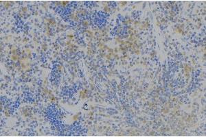 ABIN6277978 at 1/100 staining Human lymph node tissue by IHC-P. (TNFSF4 抗体)
