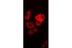 Immunofluorescent analysis of DAP staining in MCF7 cells. (DAP 抗体)