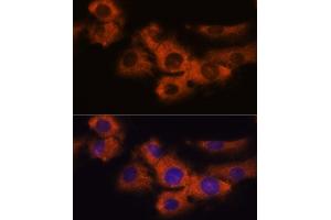 Immunofluorescence analysis of C6 cells using NDRG4 antibody  at dilution of 1:100. (NDRG4 抗体  (AA 140-220))