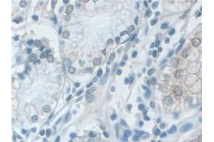 Immunohistochemistry (IHC) image for anti-Valosin Containing Protein (VCP) (AA 125-371) antibody (ABIN7440884)