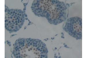 Used in DAB staining on fromalin fixed paraffin- embedded kidney tissue (Cytokeratin 5 抗体  (AA 335-473))