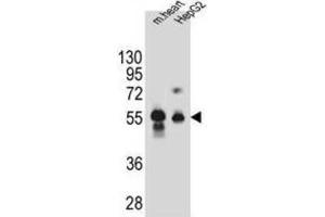 Western Blotting (WB) image for anti-Dipeptidase 3 (DPEP3) antibody (ABIN2995842) (DPEP3 抗体)