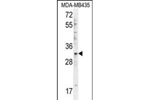DTWD1 Antibody (Center) (ABIN655477 and ABIN2845000) western blot analysis in MDA-M cell line lysates (35 μg/lane). (DTWD1 抗体  (AA 144-173))