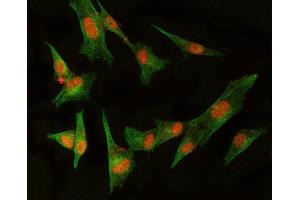 IF analysis of MED8 and Tubulin beta using anti-MED8 antibody (ABIN5519031) and anti-Tubulin beta antibody (ABIN7600339). (MED8 抗体  (AA 1-195))